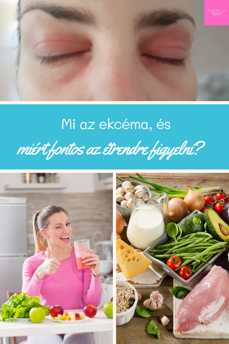 mi_az_ekcema_hogyan_ismerheted_fel