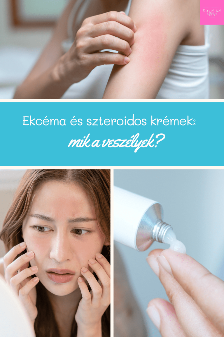 ekcema_szteroidos_kremek_mik_a_veszelyek